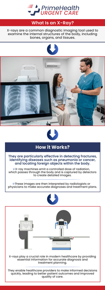 X-rays are mostly used to evaluate breaks and fractures in the bones. However, they can also be used to find issues with soft tissue, such as internal organs. You can avail of x-ray services at PrimeHealth Urgent Care. For more information, contact us or book an appointment online. Walk-ins are also welcome! We have convenient locations to serve patients in Parrish FL, Bradenton FL, Sarasota FL, Lehigh Acres FL, Estero FL, Ellenton FL, Port Charlotte FL and West Bradenton FL. X-rays are mostly used to evaluate breaks and fractures in the bones. However, they can also be used to find issues with soft tissue, such as internal organs. You can avail of x-ray services at PrimeHealth Urgent Care. For more information, contact us or book an appointment online. Walk-ins are also welcome! We have convenient locations to serve patients in Parrish FL, Bradenton FL, Sarasota FL, Lehigh Acres FL, Estero FL, Ellenton FL, Port Charlotte FL and West Bradenton FL.