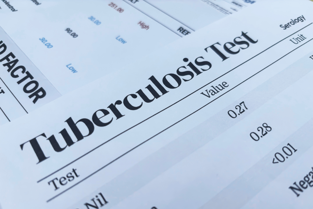 TB Test